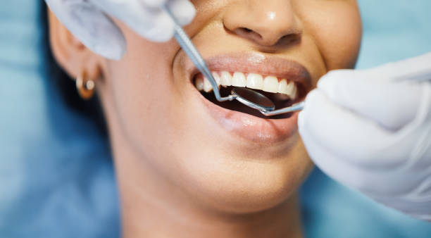 Best Urgent Tooth Repair  in Carrollton, AL